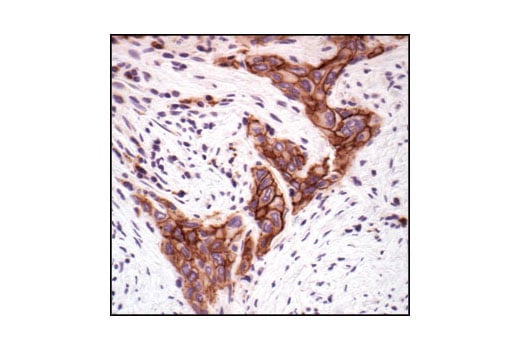 Immunohistochemistry Image 3: E-Cadherin Antibody