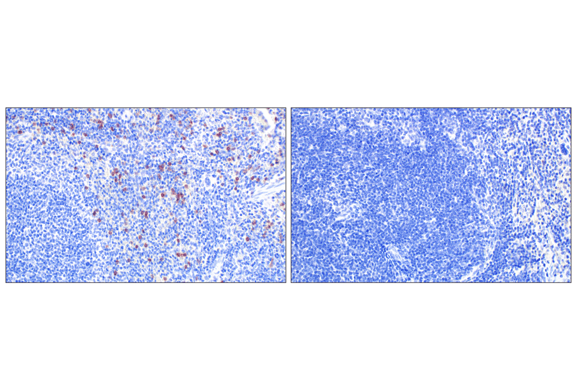 Immunohistochemistry Image 4: NCR1/NKp46 (F8M2L) Rabbit Monoclonal Antibody (IHC Formulated)