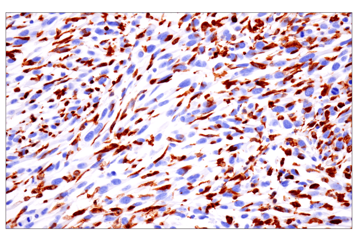 Immunohistochemistry Image 5: p47phox (F3Y6C) Rabbit Monoclonal Antibody