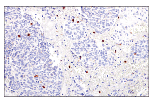 Immunohistochemistry Image 4: GITR (D5V7P) Rabbit Monoclonal Antibody (BSA and Azide Free)
