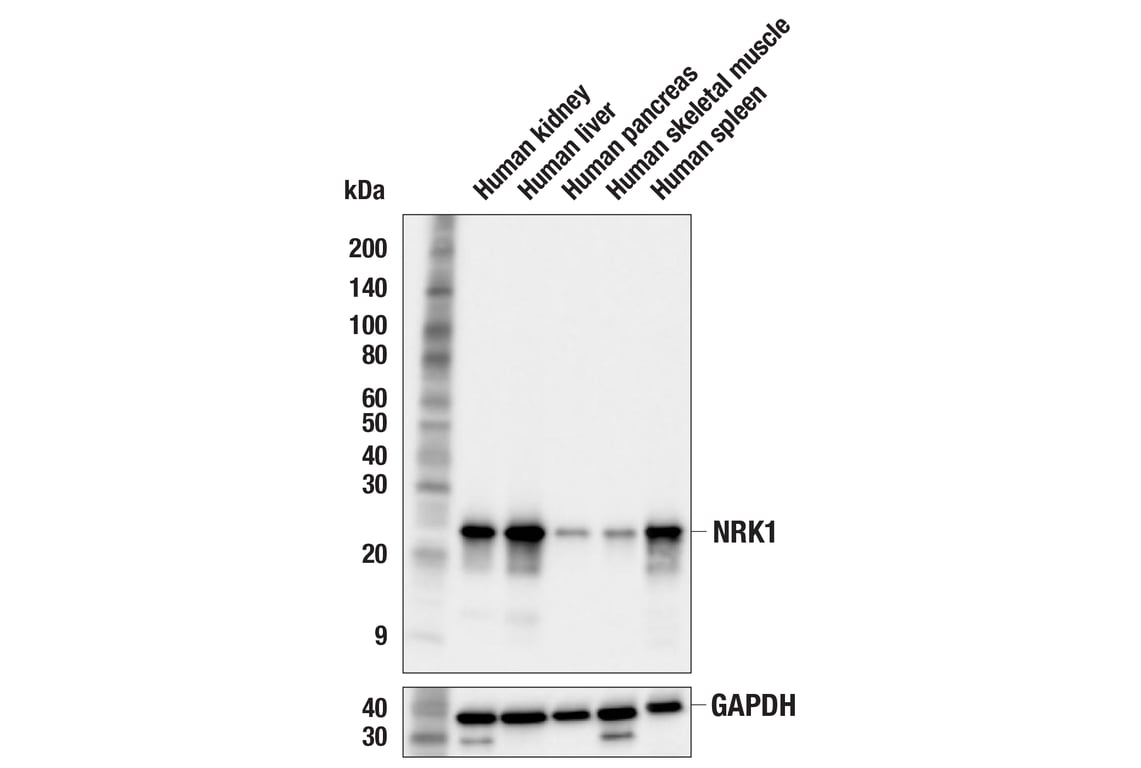 Western Blotting Image 2: NRK1 (F4F8L) Rabbit Monoclonal Antibody