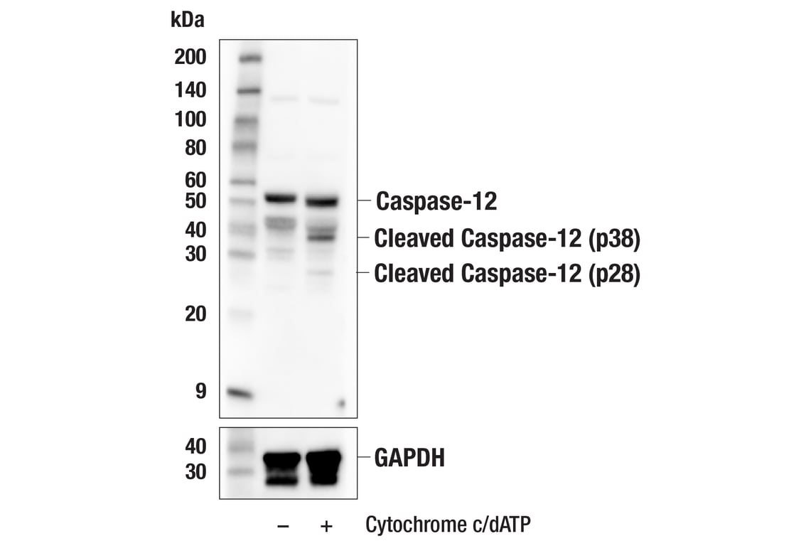 undefined Image 24: Apoptosis Antibody Sampler Kit (Mouse Preferred)
