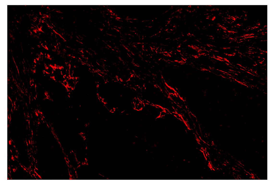 Immunohistochemistry Image 4: TMEM119 (E3E4T) & CO-0130-488 SignalStar<sup>™</sup> Oligo-Antibody Pair