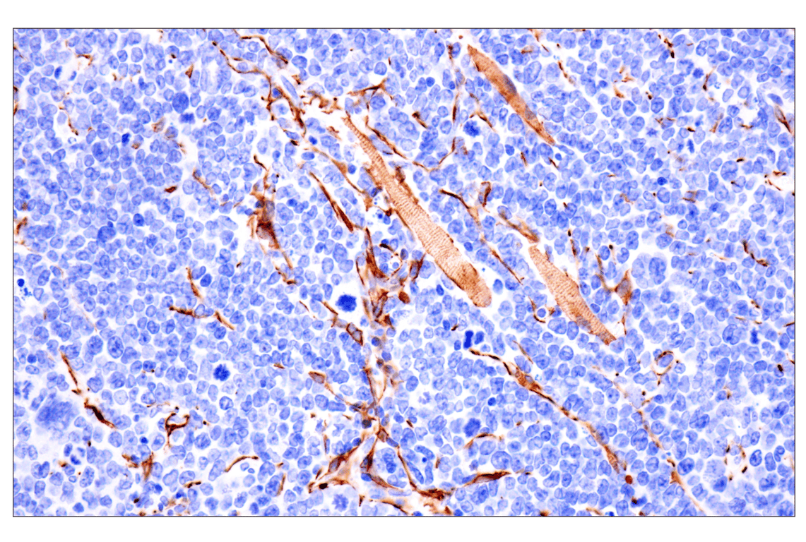 Immunohistochemistry Image 13: Desmin (F5V4I) Rabbit Monoclonal Antibody (BSA and Azide Free)