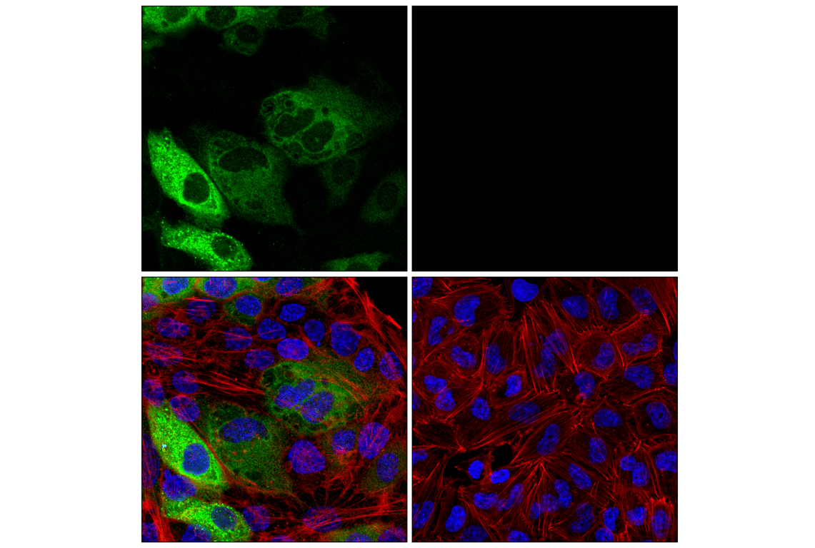Immunofluorescence Image 1: Involucrin (F9C3C) Rabbit Monoclonal Antibody