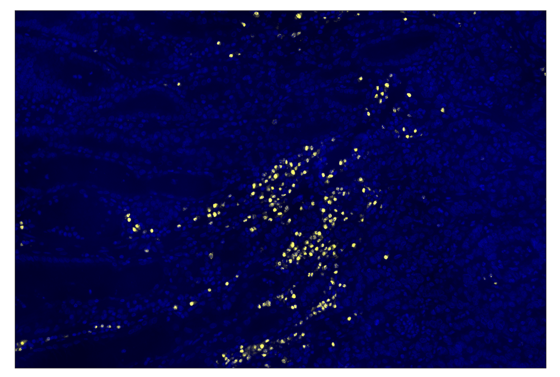 Immunohistochemistry Image 2: IRF-4 (E8H3S) & CO-0233-488 SignalStar<sup>®</sup> Oligo-Antibody Pair