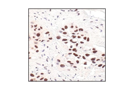 Immunohistochemistry Image 1: Survivin (71G4B7) Rabbit Monoclonal Antibody (BSA and Azide Free)