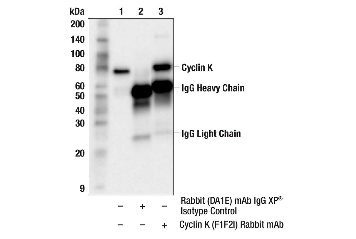 Immunoprecipitation Image 1: Cyclin K (F1F2I) Rabbit Monoclonal Antibody