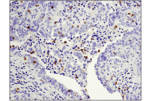 Immunohistochemistry Image 1: PD-1 (Intracellular Domain) (D4W2J) Rabbit Monoclonal Antibody (BSA and Azide Free)
