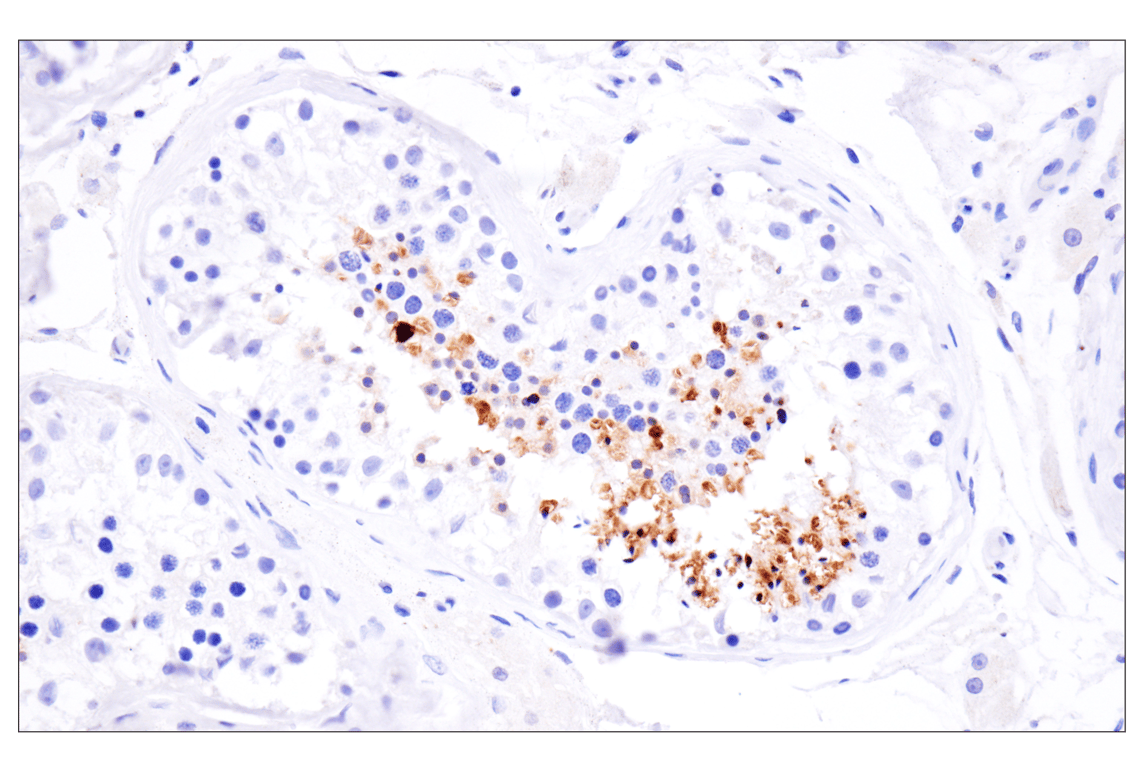 Immunohistochemistry Image 3: KK-LC-1 (F3U6C) Rabbit Monoclonal Antibody (BSA and Azide Free)