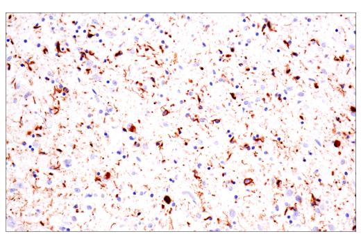 Immunohistochemistry Image 3: Phospho-Tau (Thr205) (E3E3B) Mouse Monoclonal Antibody