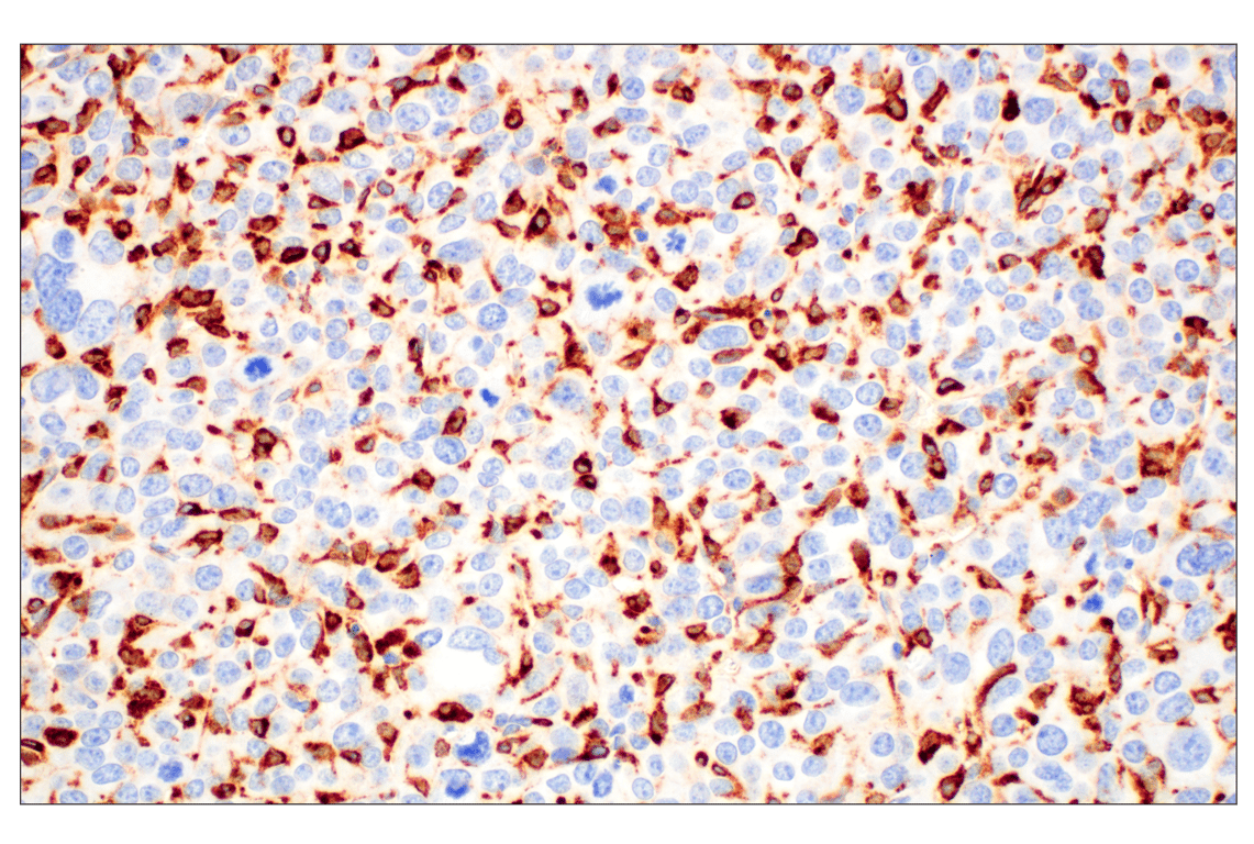 Immunohistochemistry Image 1: C1QB (E3U6X) Rabbit Monoclonal Antibody