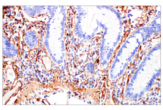 Immunohistochemistry Image 10: Nestin (E4O9E) Rabbit Monoclonal Antibody