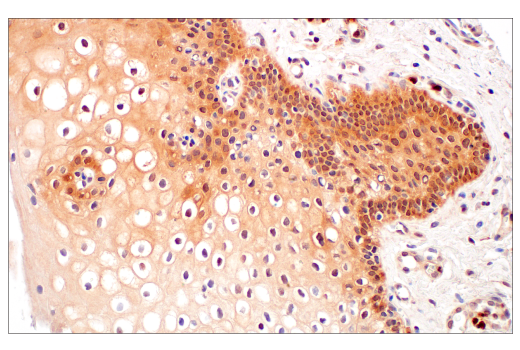 undefined Image 27: Gluconeogenesis Antibody Sampler Kit