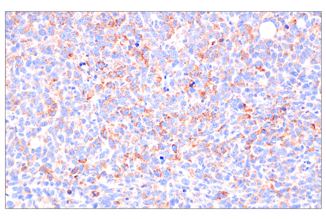 undefined Image 42: Organelle Localization IF Antibody Sampler Kit