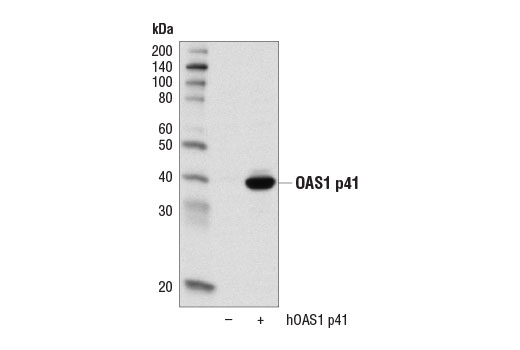 Western Blotting Image 2: OAS1 (D1W3A) Rabbit Monoclonal Antibody