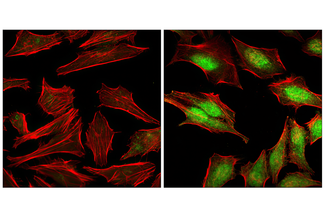Immunofluorescence Image 1: Phospho-p38 MAPK (Thr180/Tyr182) Antibody