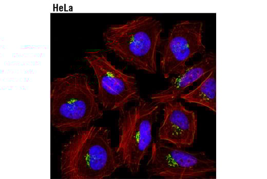 Immunofluorescence Image 1: Golgin-97 (D8P2K) Rabbit Monoclonal Antibody