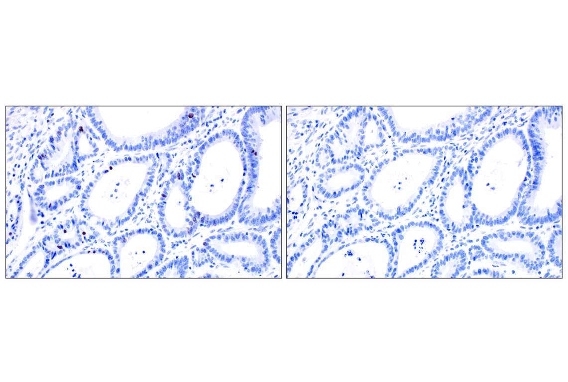 Immunohistochemistry Image 8: Phospho-Histone H3 (Ser10) (D7N8E) Rabbit Monoclonal Antibody (BSA and Azide Free)