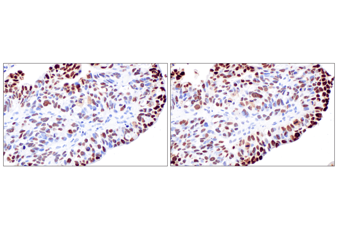 Immunohistochemistry Image 4: CT45 (F7S2I) Rabbit Monoclonal Antibody