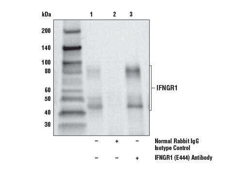 undefined Image 16: IFN-gamma Signaling Pathway Antibody Sampler Kit