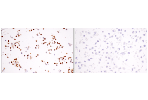 Immunohistochemistry Image 6: ASCL1 (E5S4Q) XP<sup>®</sup> Rabbit mAb