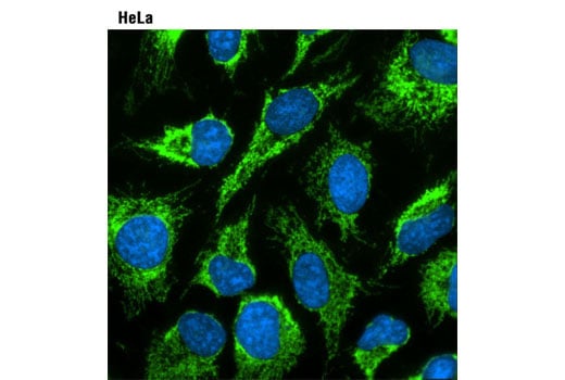 Immunofluorescence Image 1: ProLong<sup>®</sup> Gold Antifade Reagent with DAPI