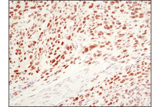 undefined Image 13: PhosphoPlus<sup>®</sup> Ezh2 (Thr311) Antibody Duet