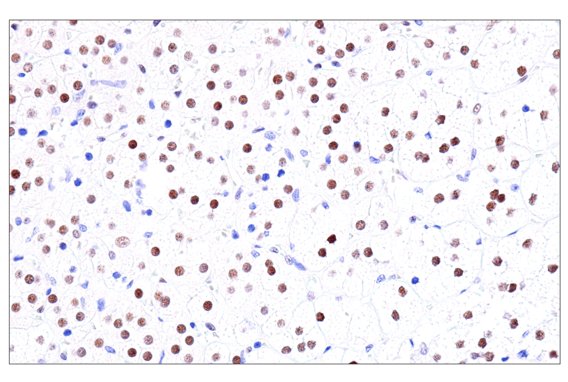 Immunohistochemistry Image 15: GATA-6 (D61E4) XP<sup>®</sup> Rabbit mAb