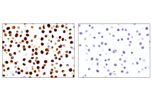 Immunohistochemistry Image 6: IRF-4 (E8H3S) XP<sup>®</sup> Rabbit mAb