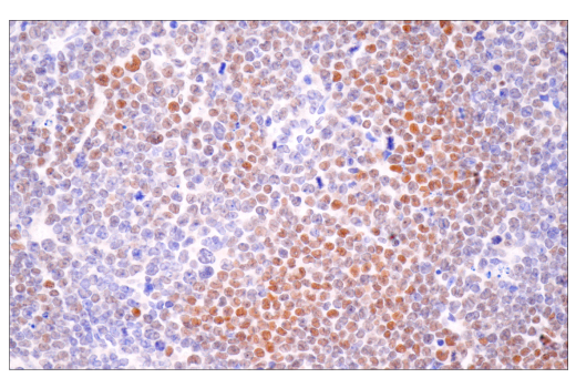 Immunohistochemistry Image 5: HIF-1 alpha (E1V6A) Rabbit Monoclonal Antibody (BSA and Azide Free)