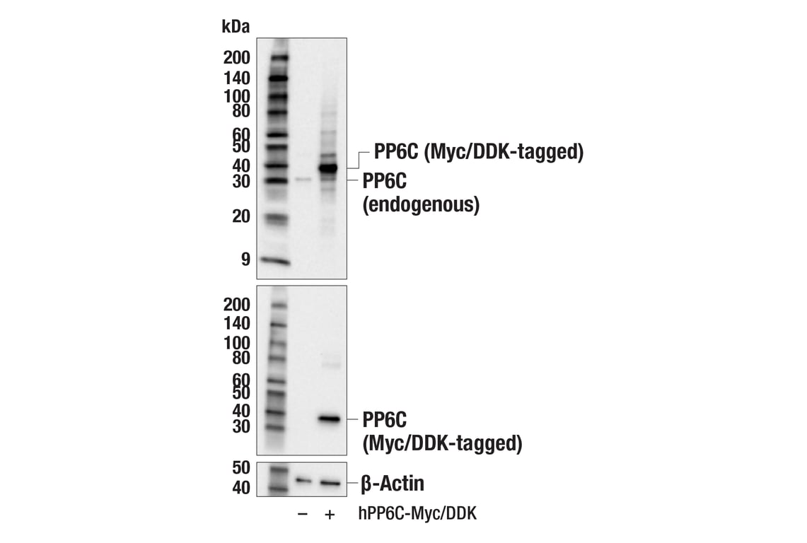 Western Blotting Image 2: PP6C (E3V2A) Rabbit Monoclonal Antibody