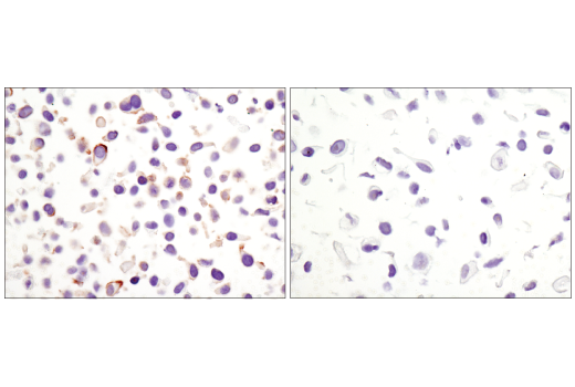 Immunohistochemistry Image 4: Non-phospho (Active) beta-Catenin (Ser33/37/Thr41) (D13A1) Rabbit Monoclonal Antibody (BSA and Azide Free)