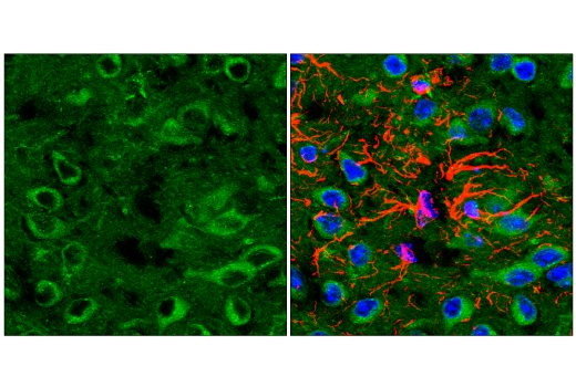 Immunofluorescence Image 2: Rab7 (E9O7E) Mouse Monoclonal Antibody
