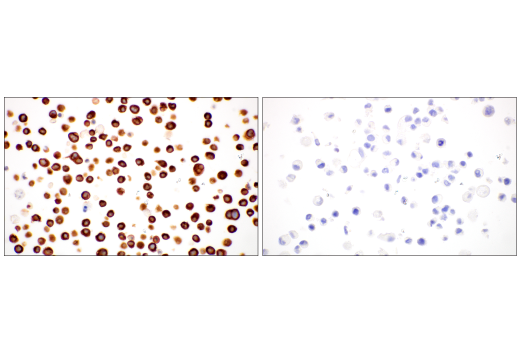 Immunohistochemistry Image 14: Nestin (E4O9E) XP<sup>®</sup> Rabbit mAb