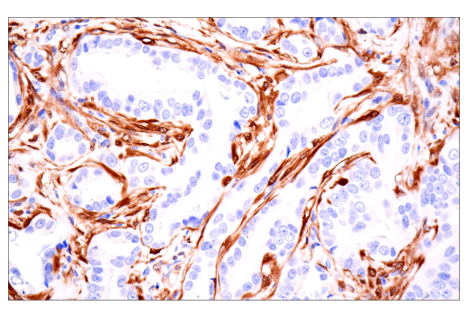 Immunohistochemistry Image 1: NNMT (E6N2Z) Rabbit Monoclonal Antibody