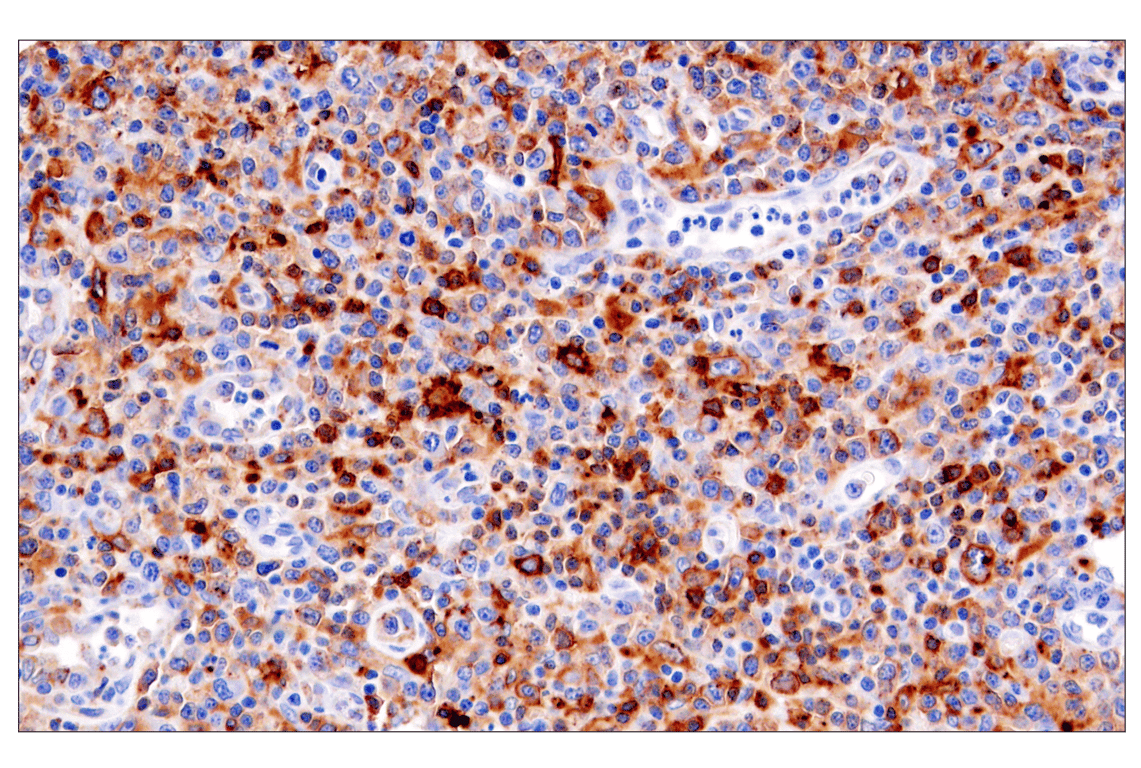 Immunohistochemistry Image 3: HLA-DRA (E9R2Q) Rabbit Monoclonal Antibody