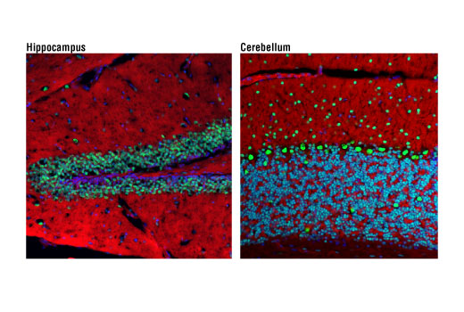 Immunofluorescence Image 1: Ezh2 (D2C9) Rabbit Monoclonal Antibody (BSA and Azide Free)