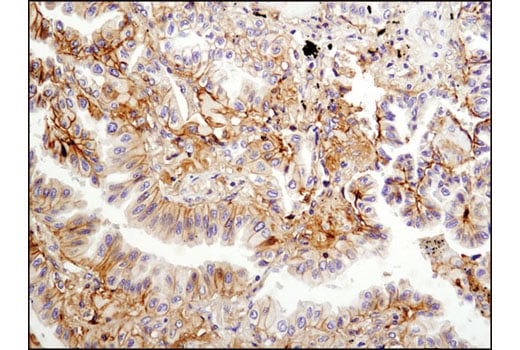 undefined Image 25: SARS-CoV-2 Virus-Host Interaction Antibody Sampler Kit