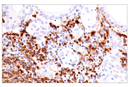 Immunohistochemistry Image 1: TNFRSF13C/BAFF-R (E3C1Q) Rabbit Monoclonal Antibody (BSA and Azide Free)