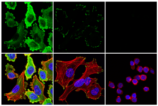 Immunofluorescence Image 1: Paxillin (E6R6Z) Rabbit Monoclonal Antibody