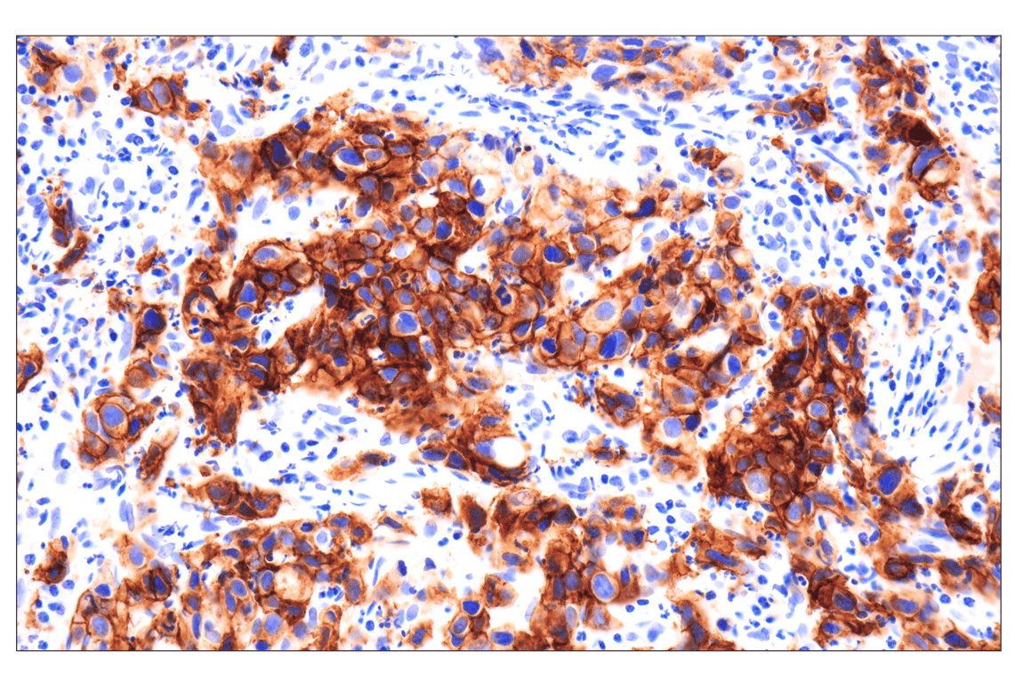 Immunohistochemistry Image 1: FGF Receptor 2 (D4L2V) Rabbit Monoclonal Antibody (BSA and Azide Free)