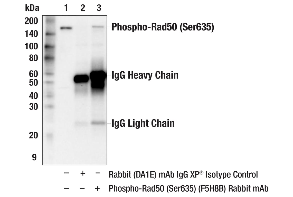 Immunoprecipitation Image 1: Phospho-Rad50 (Ser635) (F5H8B) Rabbit mAb