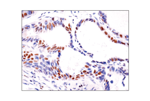 Immunohistochemistry Image 5: HAUSP (D17C6) Rabbit Monoclonal Antibody