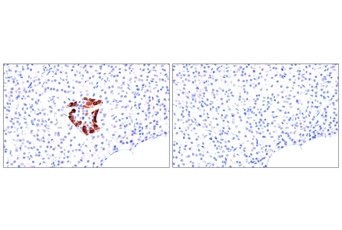 Immunohistochemistry Image 14: FAP (F1A4G) Rabbit mAb