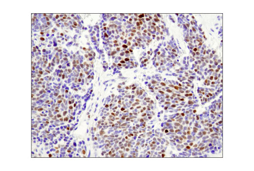 Immunohistochemistry Image 1: N-Myc (D4B2Y) Rabbit Monoclonal Antibody (BSA and Azide Free)