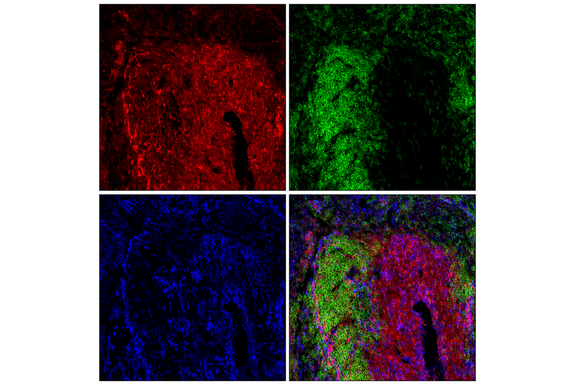 Immunofluorescence Image 2: STING (E9X7F) Rabbit Monoclonal Antibody (Alexa Fluor<sup>®</sup> 594 Conjugate)