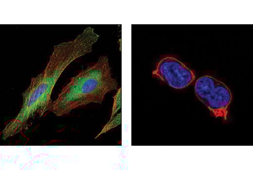 Immunofluorescence Image 1: SHIP2 (C76A7) Rabbit Monoclonal Antibody