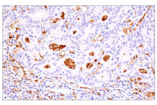 Immunohistochemistry Image 4: DAP12 (E8P9U) Rabbit Monoclonal Antibody (BSA and Azide Free)
