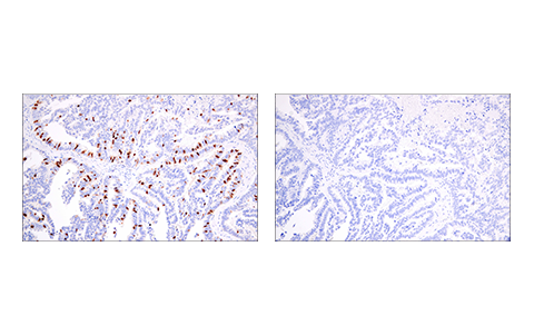 Immunohistochemistry Image 4: Geminin (E5Q9S) XP<sup>®</sup> Rabbit mAb (BSA and Azide Free)